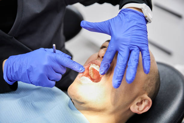 Best Emergency Root Canal Treatment in Monrovia, IN